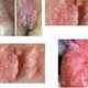 Illustration for article titled Apa Merek Obat Penyakit Jengger Ayam Dari Denatureem/em